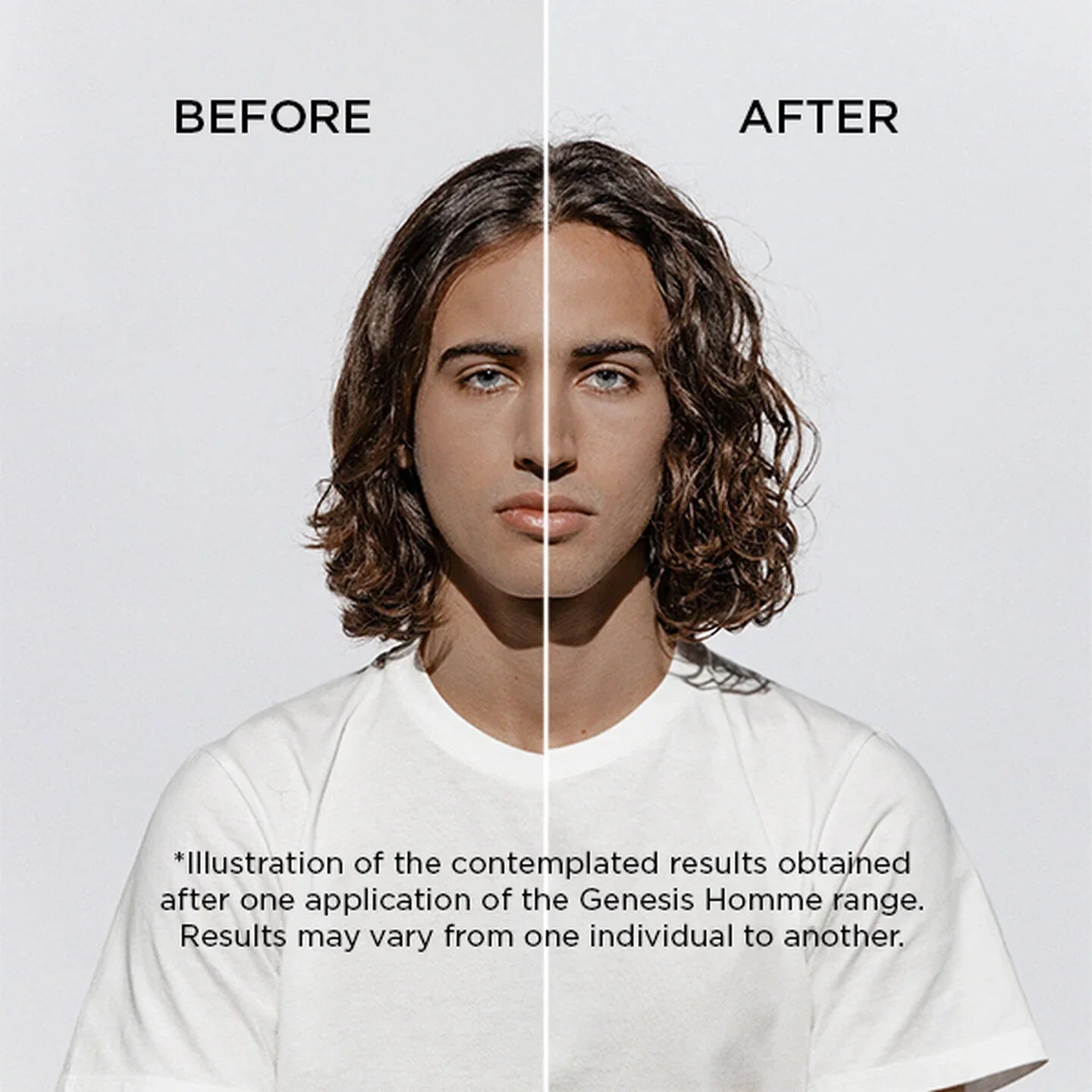 Before and after comparison of a person withGenesis Homme product application.