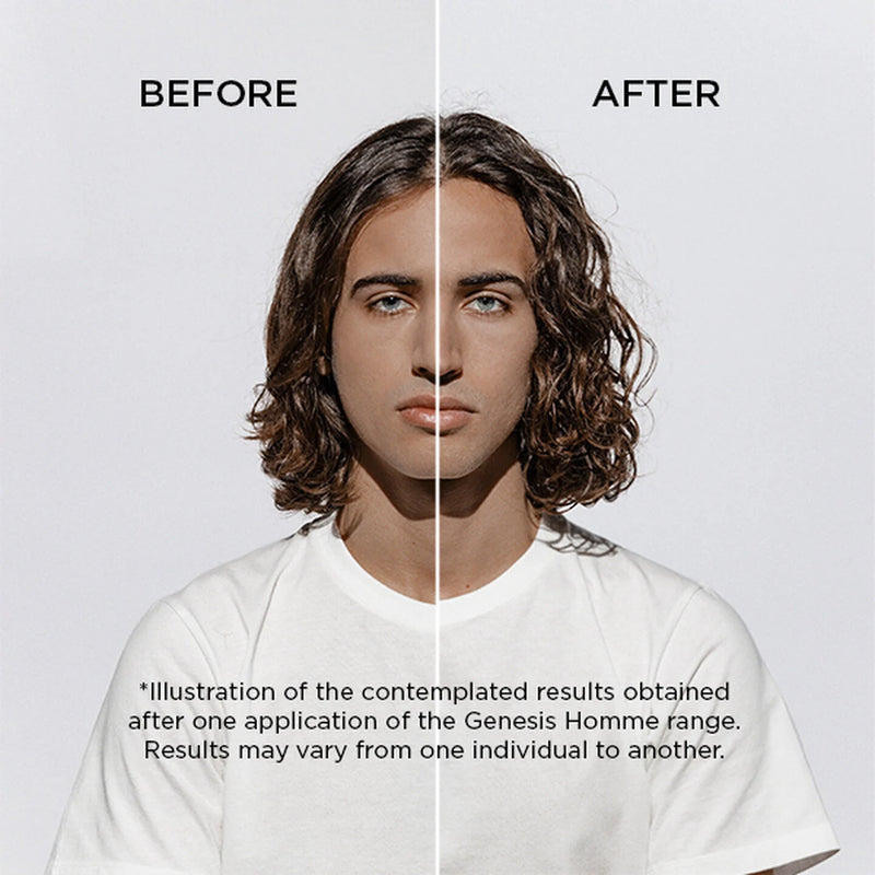 Before and after comparison of a person withGenesis Homme product application.