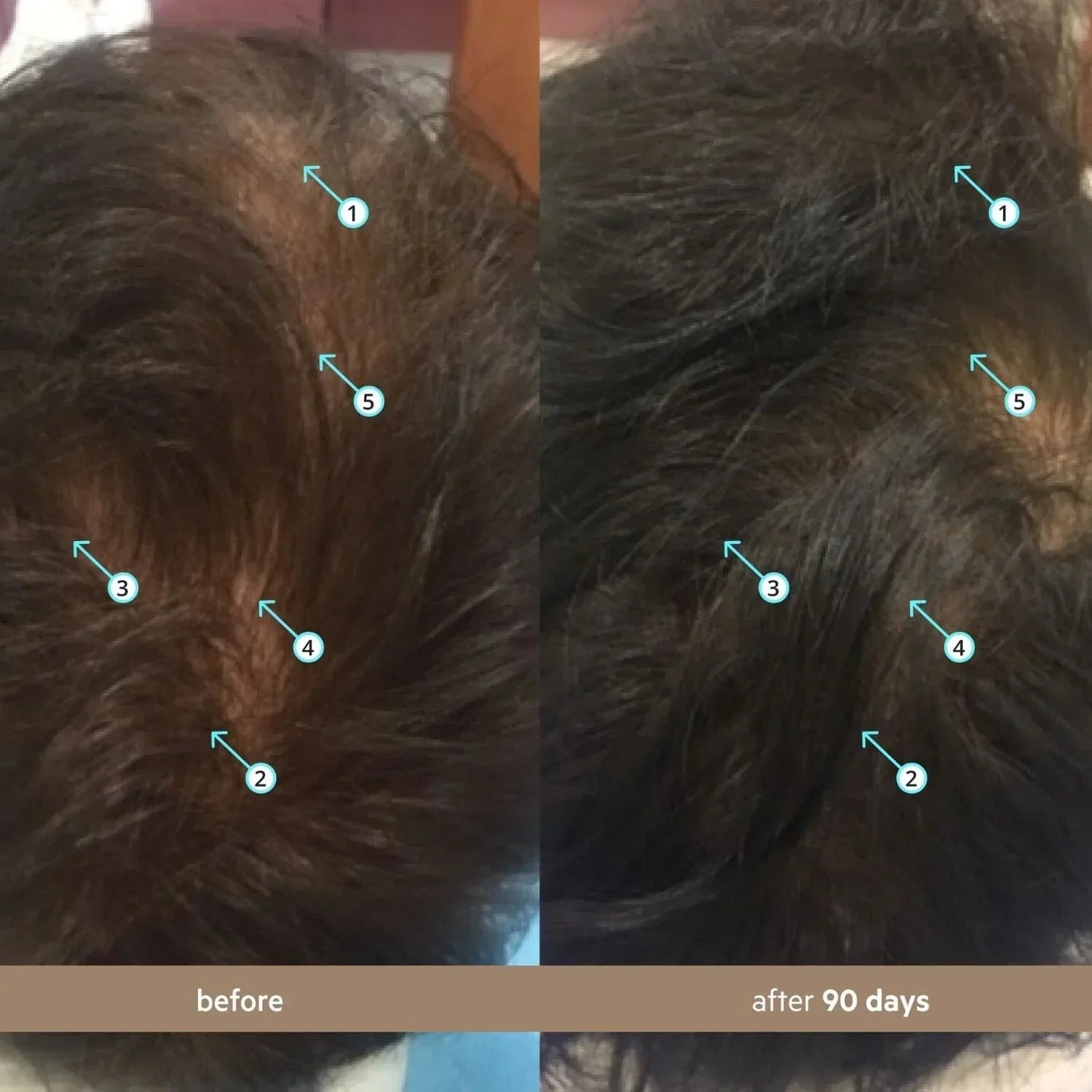 Hair model where to apply serum