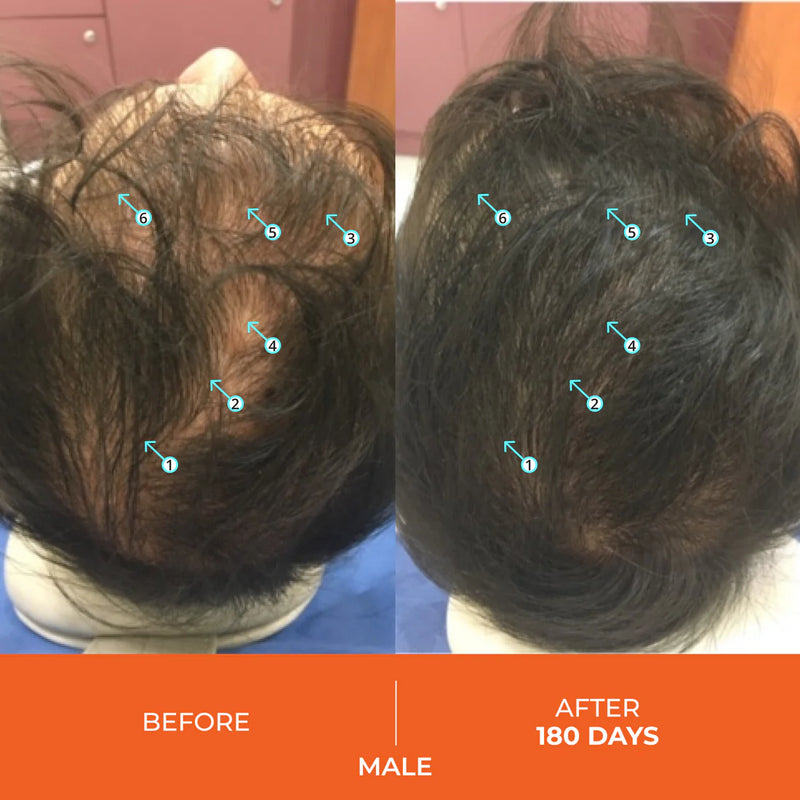DS Laboratories Revita Hair Growth Support Gummies male 2