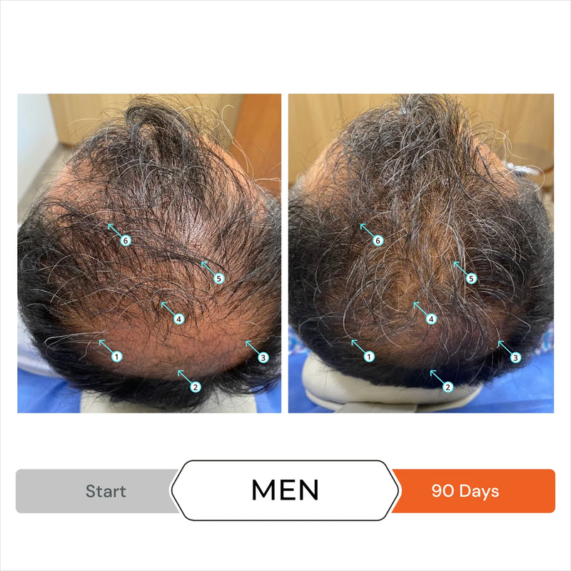 Revita Conditioner before after men