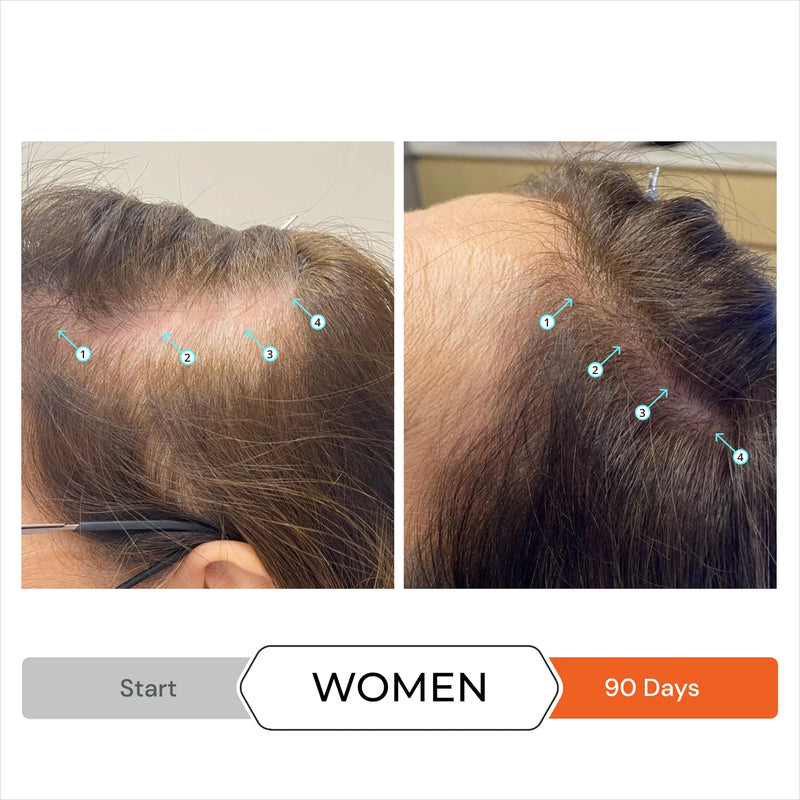Revita Conditioner before after women