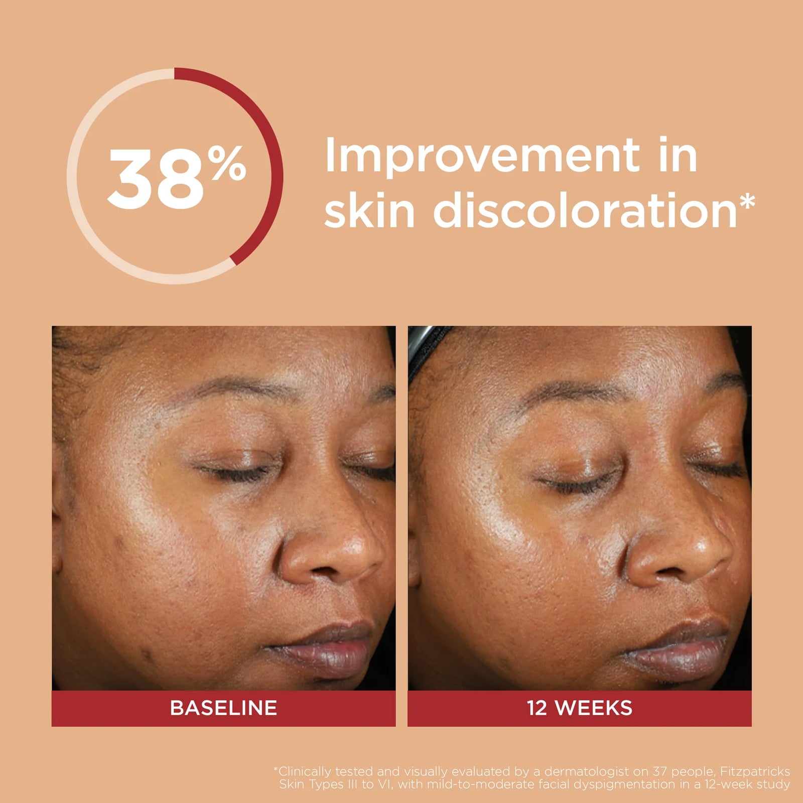 Elta uv clear broad spectrum spf 46 online