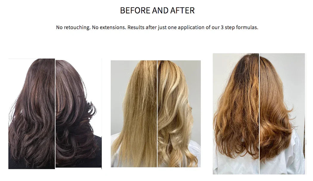 Iles Formula before and after